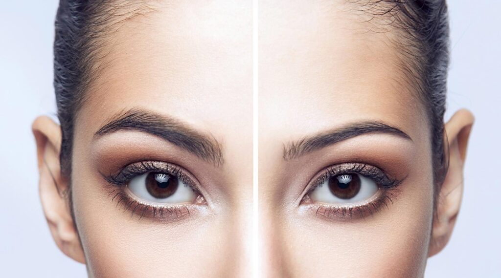 How to get Rid of Thin Eyebrows