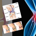 Knee Pain and Popping: Causes & Treatment